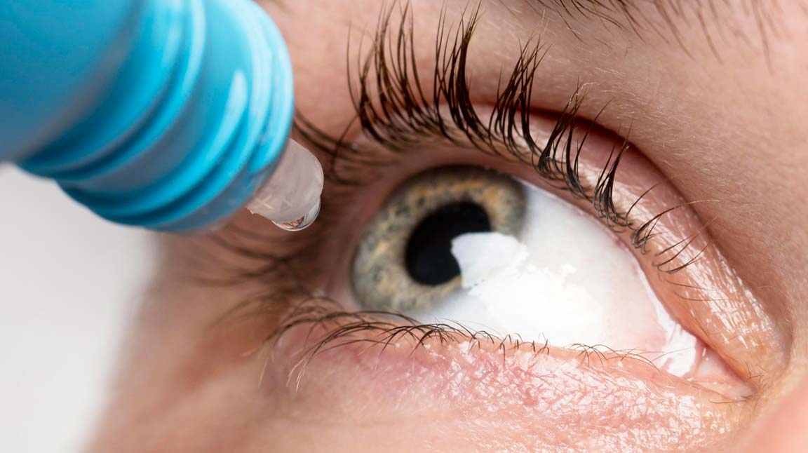 Lágrima artificial y gotas oculares para el tratamiento del ojo